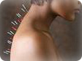 ACUPUNCTURE