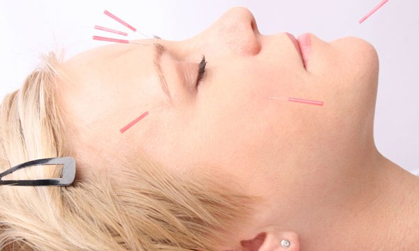 Acupuncture along with anti-depressants helps fight severe depression