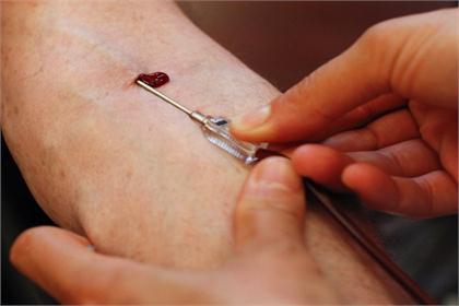 Simple blood test could help millions suffering from IBS and IBD