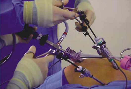 Bariatric surgery helps boost sexual function in women